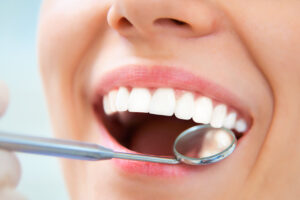 東京の根管治療専門外来、笠原デンタルオフィスで、歯の寿命を延ばす「MTAセメント」って何？失敗、後悔しないための基礎知識について解説