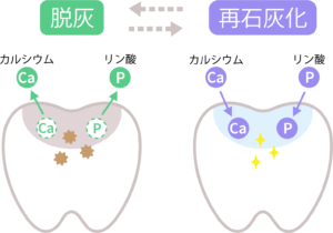 更年期で歯がボロボロに？歯の痛み・歯ぐきの腫れ・歯の脆弱化の原因と治療法