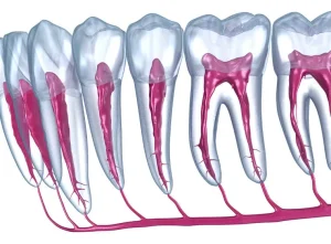 東京（江戸川区小岩）の根管治療専門外来｜笠原デンタルオフィスで、【歯髄保存療法】「歯髄（神経）」を守り抜くための治療法について解説