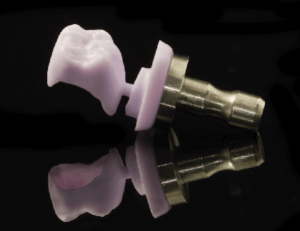 東京の根管治療専門外来、笠原デンタルオフィスで、銀歯は今は使われてない？残っている銀歯は変えなくてはだめ？取り替える見極め基準について解説