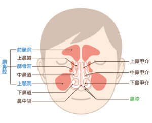 東京の根管治療専門外来、笠原デンタルオフィスで、歯が原因で蓄膿症に？「歯性上顎洞炎」の正体と、抜かずに治す精密根管治療の可能性について解説