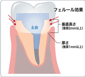 東京の根管治療専門外来、笠原デンタルオフィスで、「根っこしかない歯」は抜歯しかない？歯を残すための基準と治療法について解説