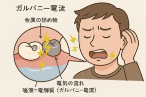 東京の根管治療専門外来、笠原デンタルオフィスで、神経を抜いた歯がしみるのはなぜ？冷たいもの・熱いもので痛む原因と抜歯を防ぐ治療法を解説