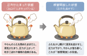 東京の根管治療専門外来、笠原デンタルオフィスで、根管治療で歯を開けっ放し（根管開放）にされたけれど大丈夫？行う理由と知っておくべきリスク・注意点